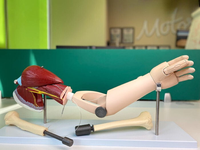 Государство оценило в 10 миллиардов производителя бионических протезов