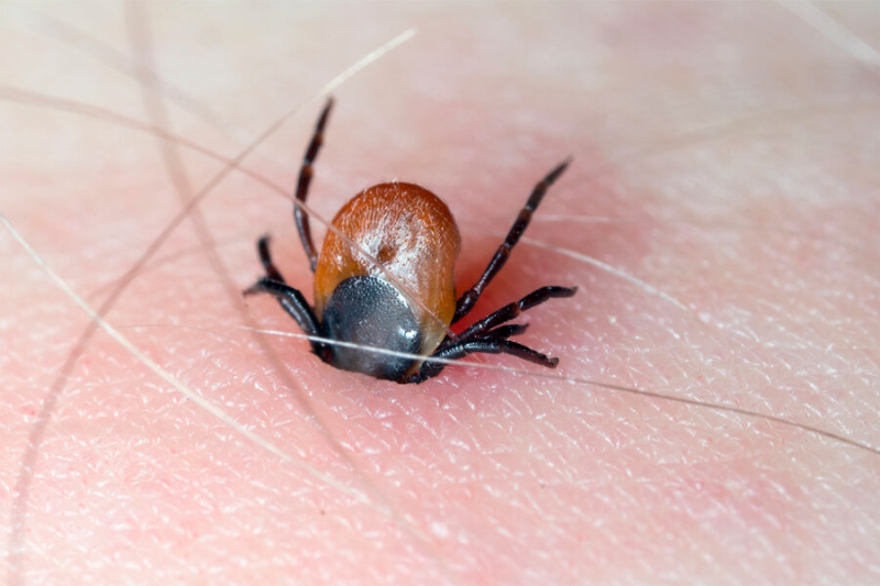 Россиянам напомнили о правилах самостоятельного удаления клеща