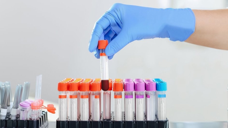 "Газета.Ru" выяснила, что происходит с анализами после их сдачи