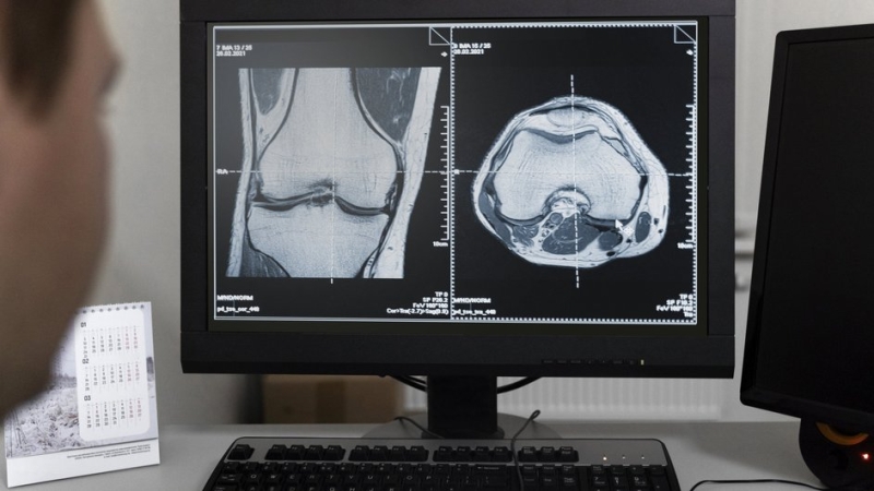 Рентгеновский снимок костей